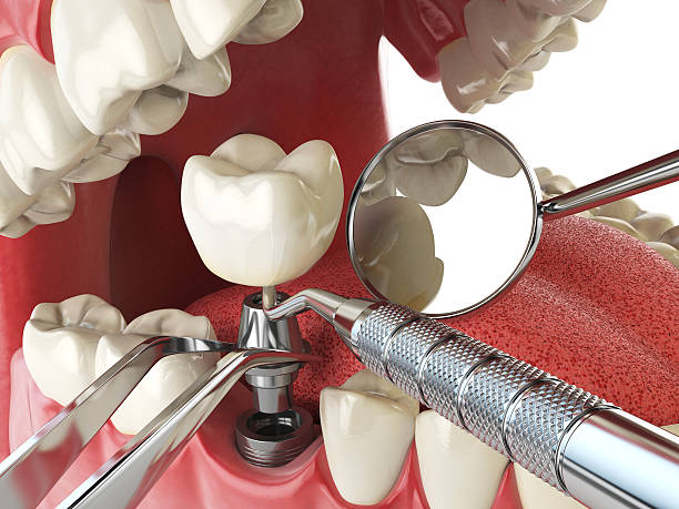 Best Emergency Cosmetic Dentistry in Delshire, OH